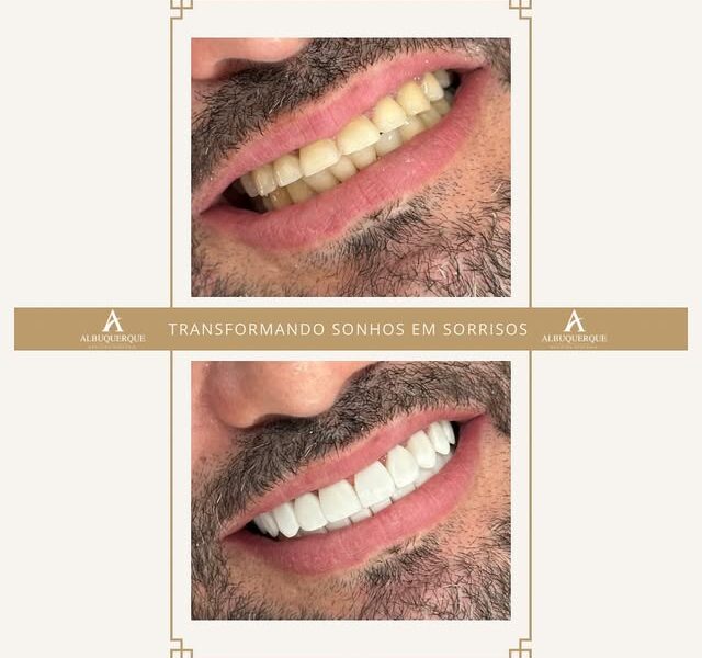 Albuquerque Medicina Dentária