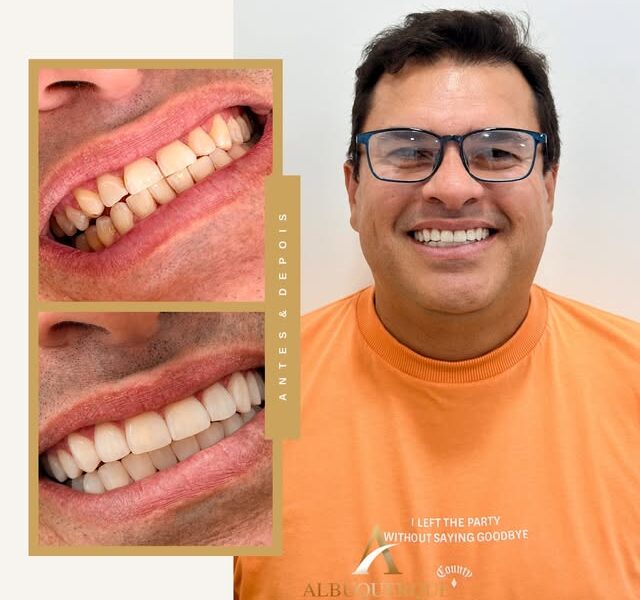 Albuquerque Medicina Dentária
