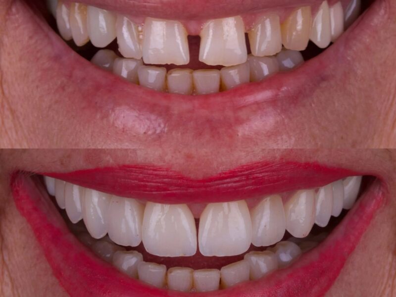 BONFANTE Dental Clinic