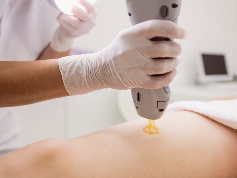 Laser Definitivo Graziela Moniz | Depilação a Laser Alcabideche Cascais