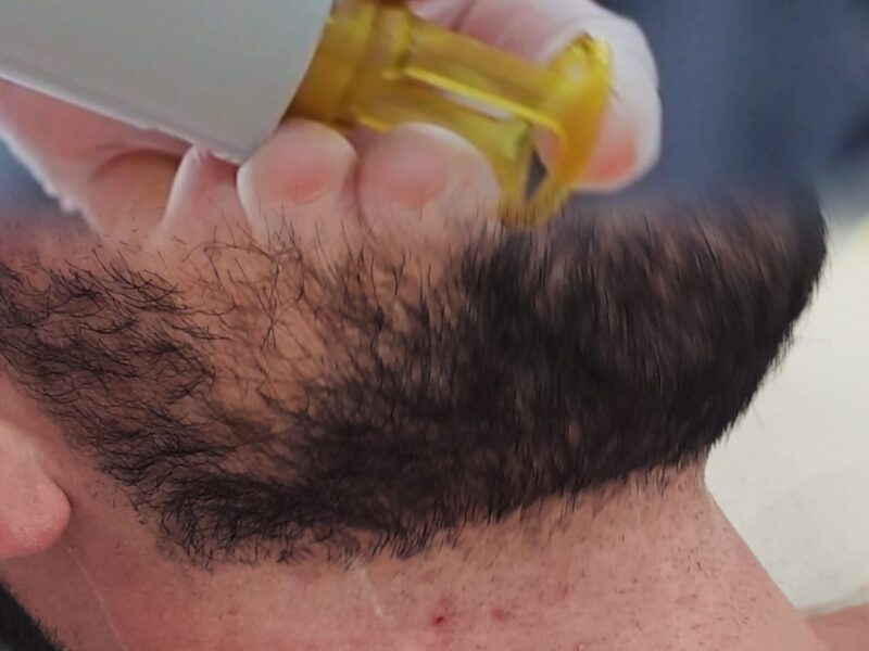 Laser Definitivo Graziela Moniz | Depilação a Laser Alcabideche Cascais