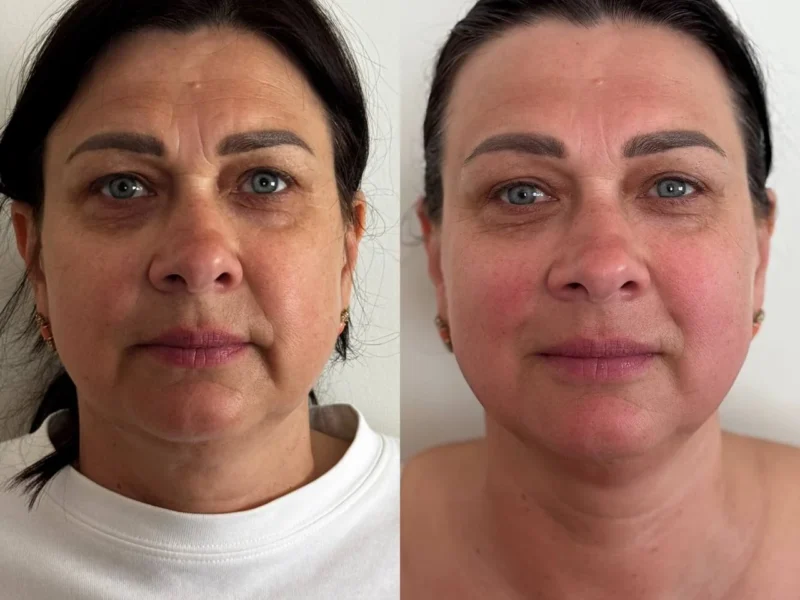 ReBloom Face Massage Studio | Cascais