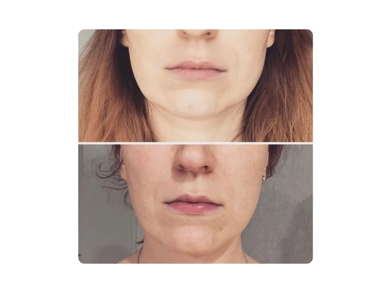 ReBloom Face Massage Studio | Cascais